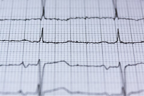 blur-chart-check-up-415779-480x320.jpg